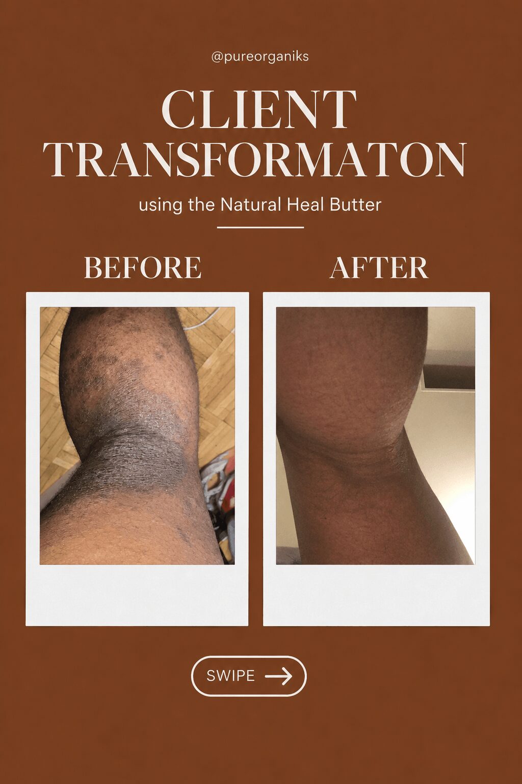 Comparison of skin condition before and after using Natural Heal Butter, showing improvement in skin appearance.