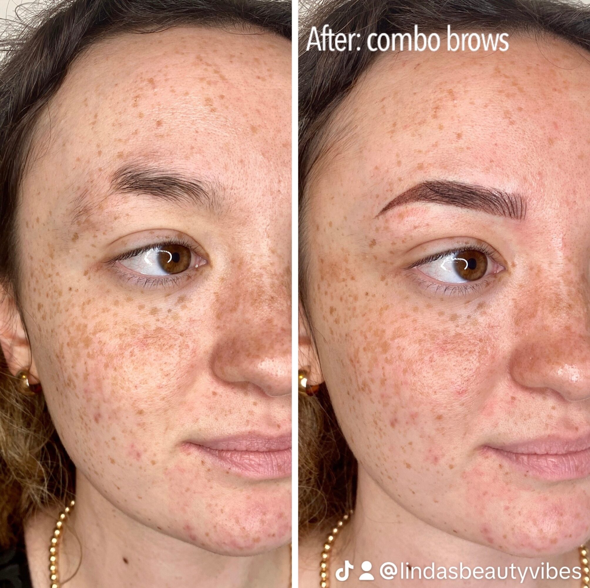 Side-by-side comparison of a woman's face showing improved eyebrow appearance after a cosmetic procedure, with visible skin changes.