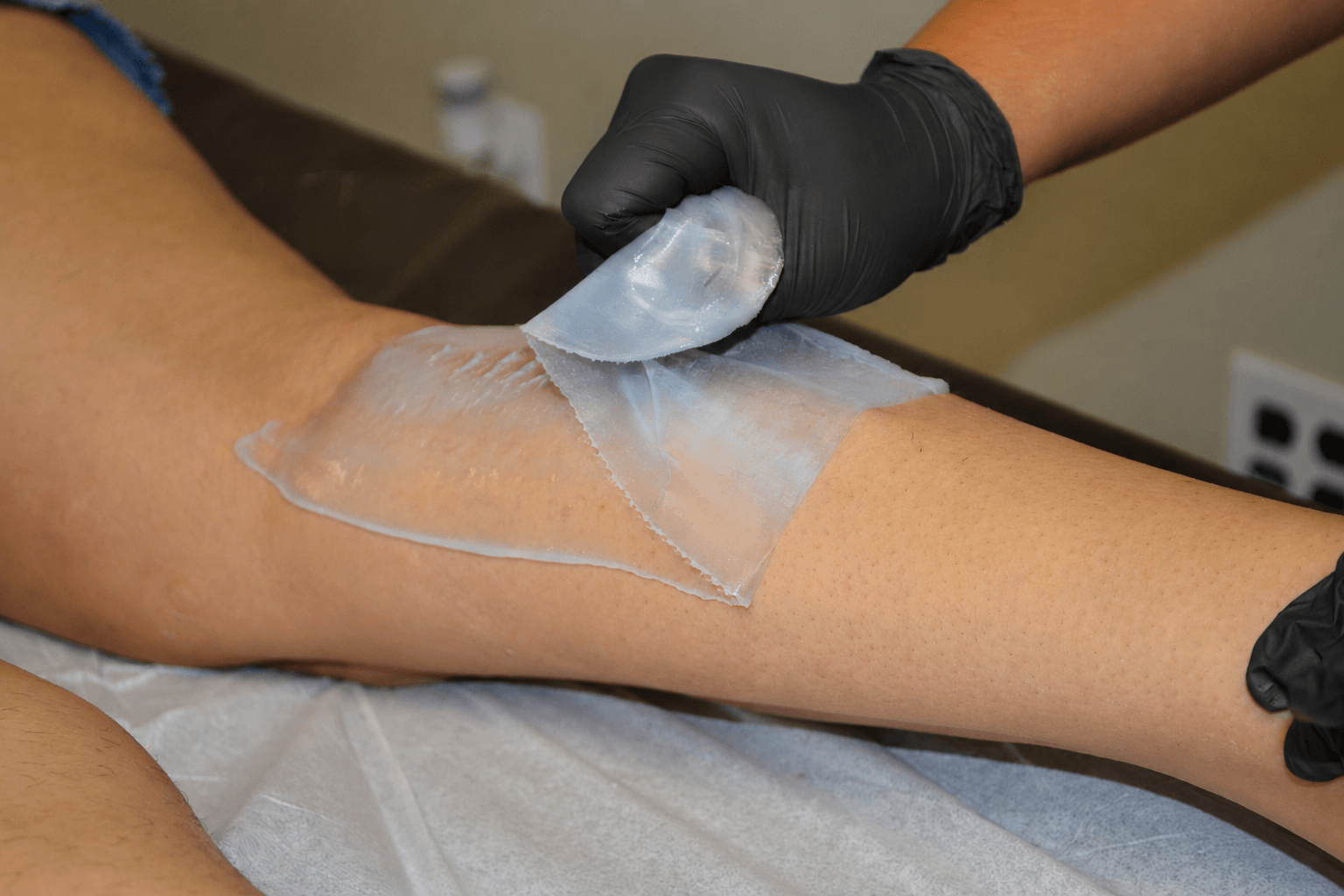 Person applying a transparent wax strip to a person's arm for hair removal, wearing black gloves.