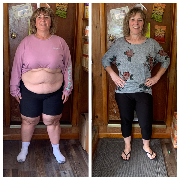 Before and after photos of a woman showing weight loss, standing indoors, smiling, with hands on hips in the after photo.