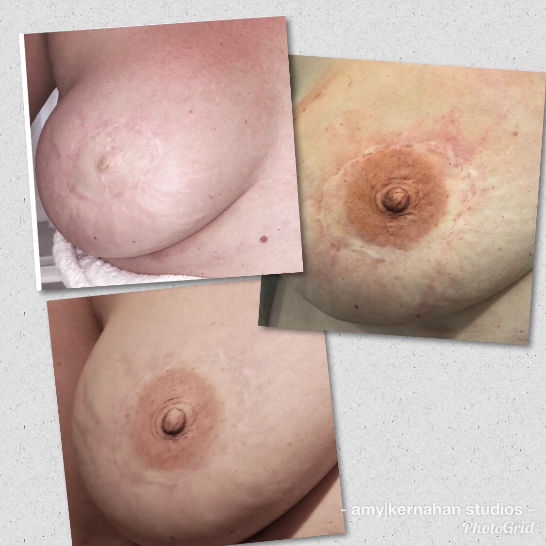 Close-up of a person's breast and nipple, showing skin texture and natural features.