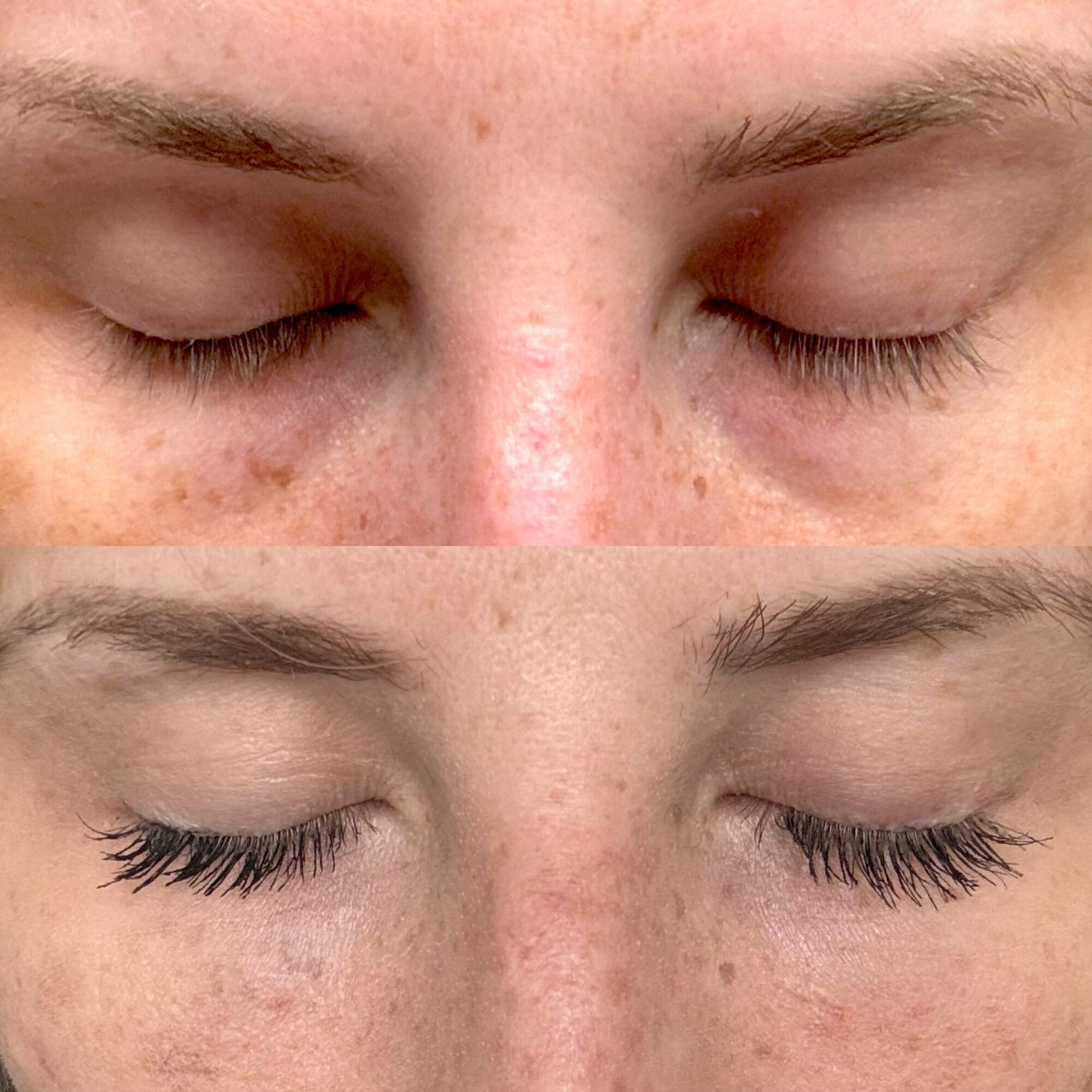 Close-up of a person's face with eyes closed, showing skin details and freckles.