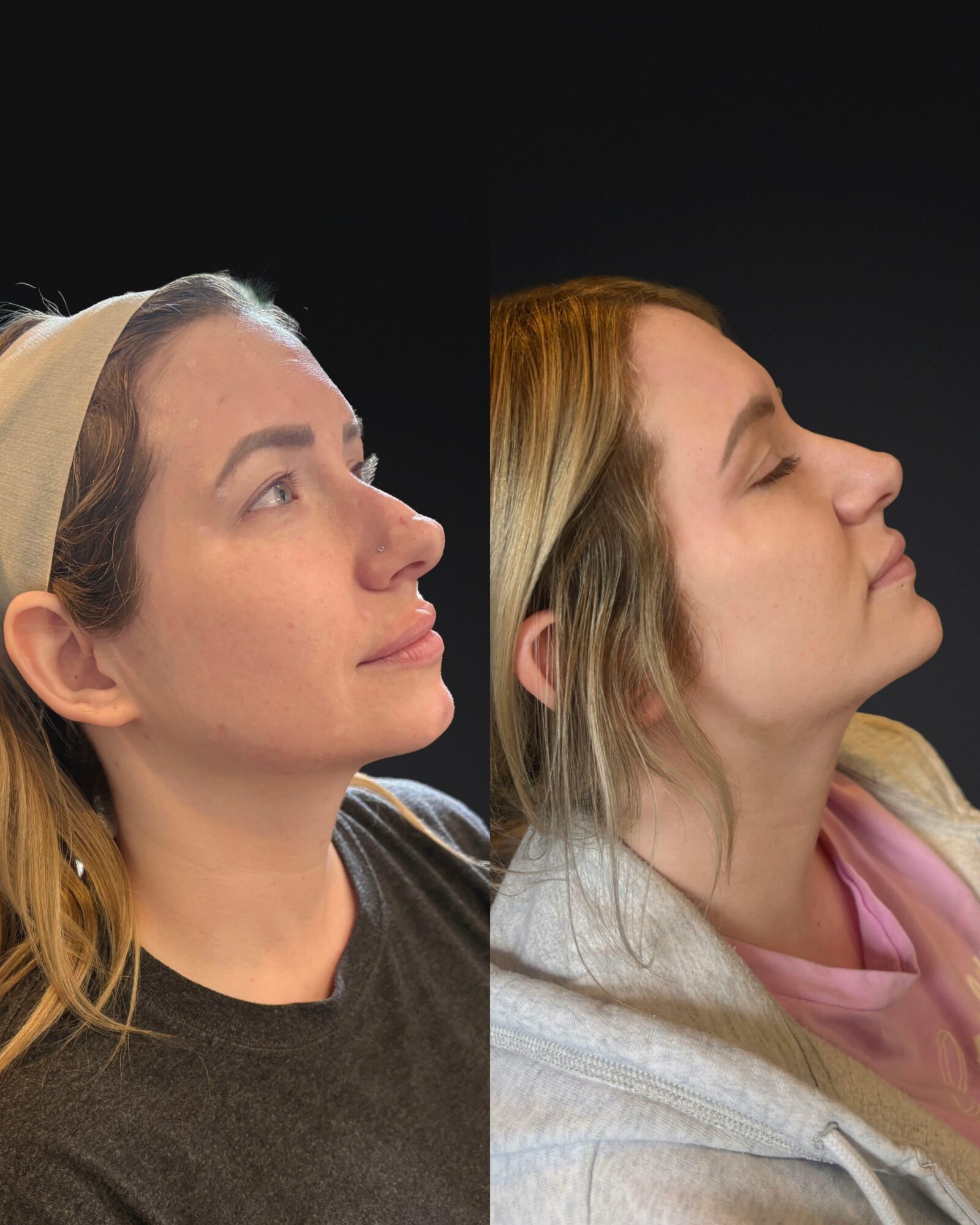 Side-by-side profile of two women, one with light brown hair and the other with blonde hair, both with eyes closed, facing right.