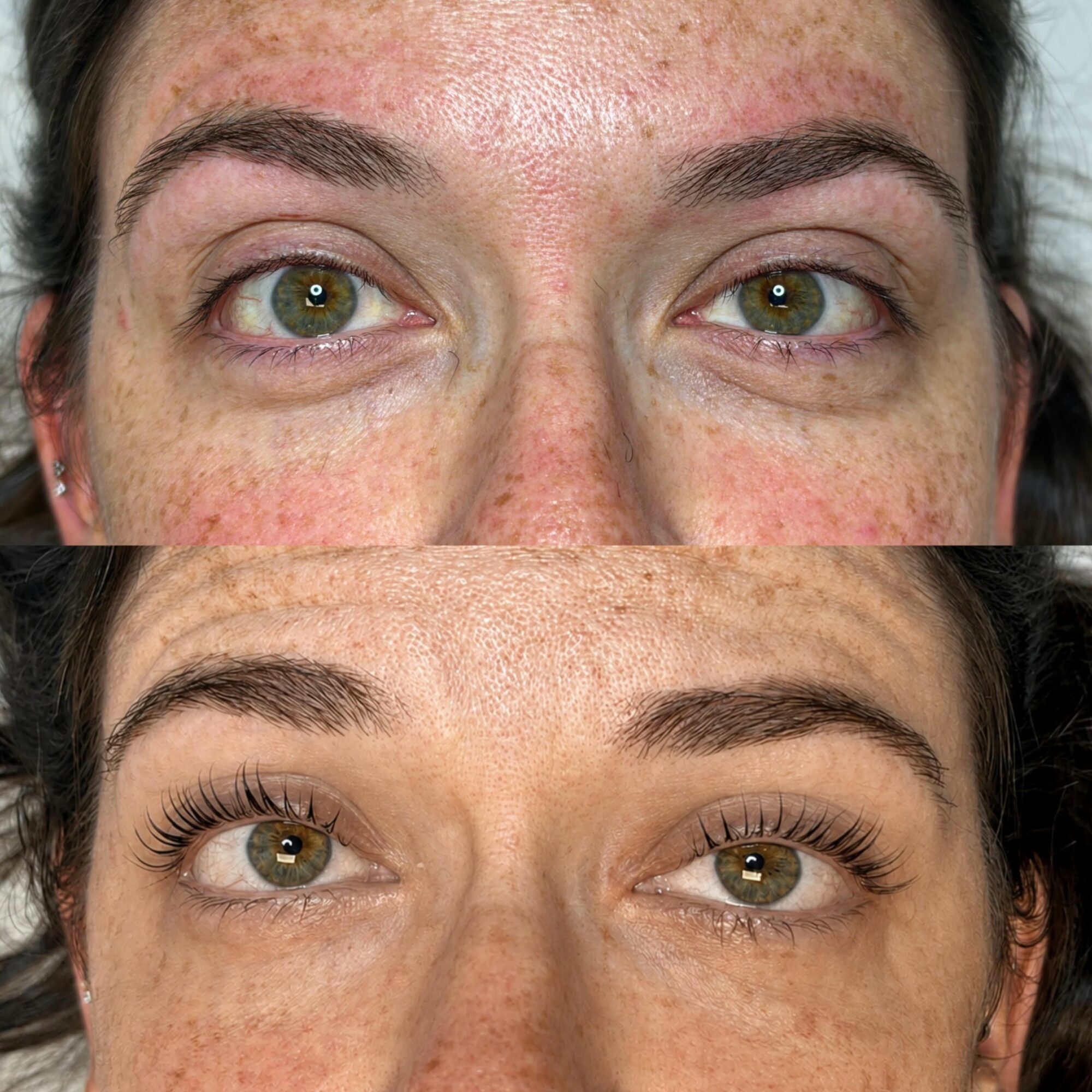 Close-up of a woman's face showing before and after skin treatment, focusing on eyes and skin texture.