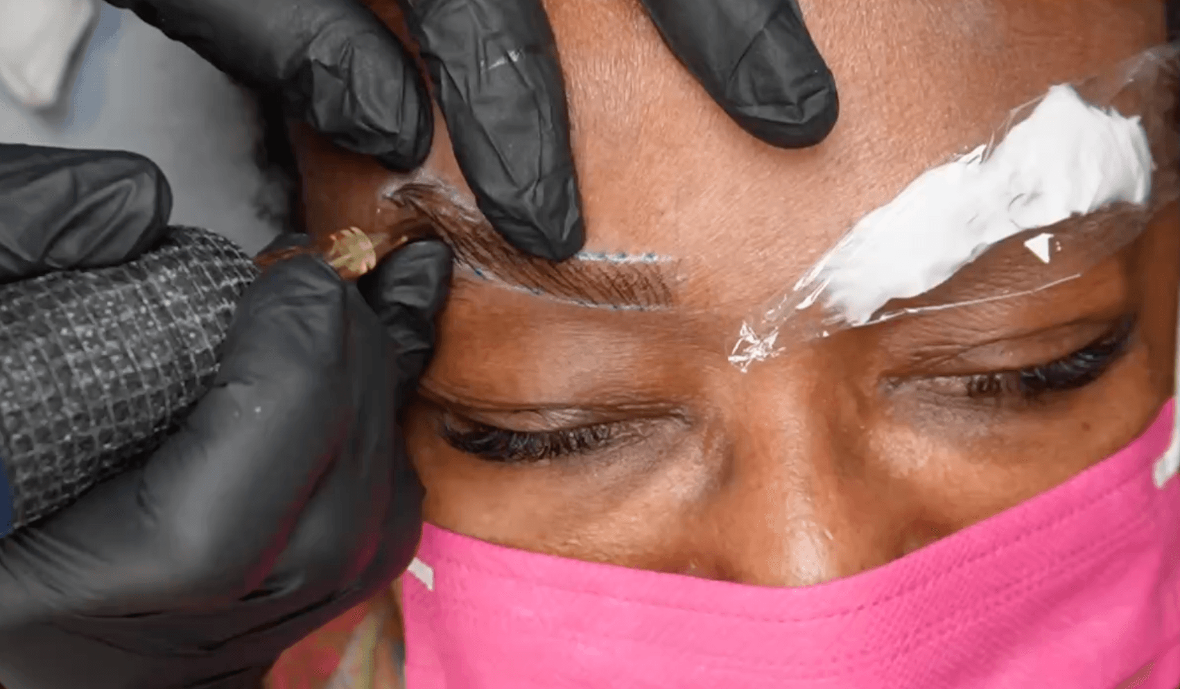 Person receiving eyebrow tattooing or microblading procedure with a technician applying pigment, wearing gloves and a pink mask.